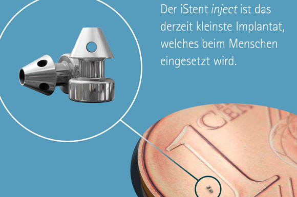 Winzige Pünktchen: So klein sind sogenannte Augen-Stents im Vergleich zur 1-Cent-Münze.